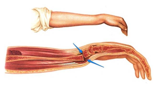 جراح ارتوپد دست