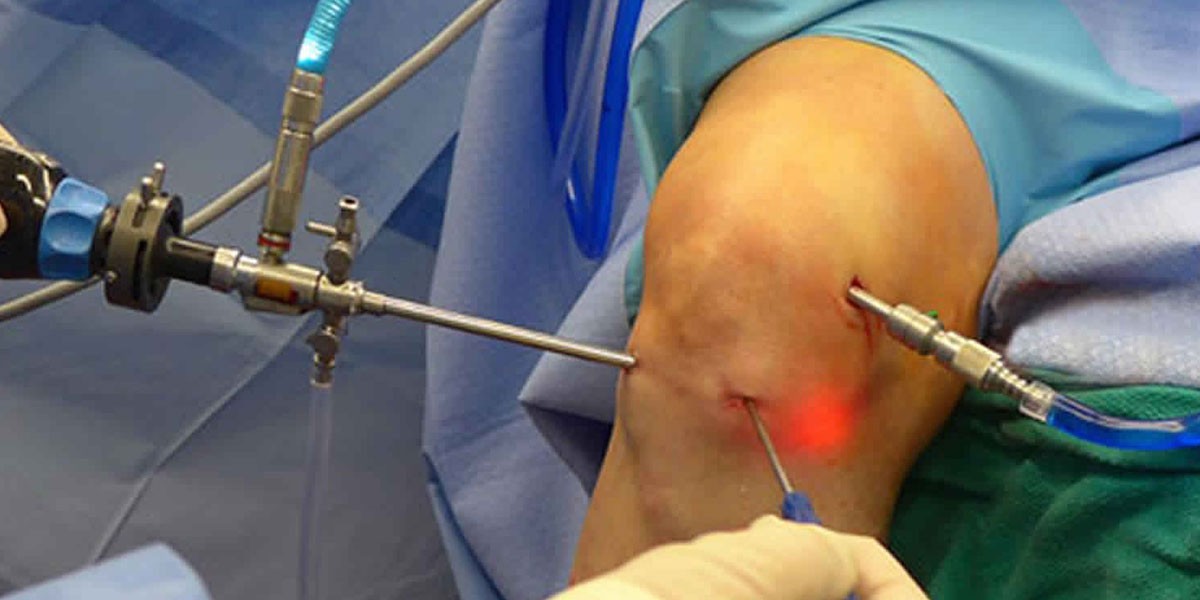 جراح منیسک مشهد