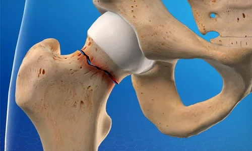 دکتر ارتوپد مشهد