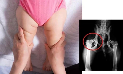 استخوان‌ها