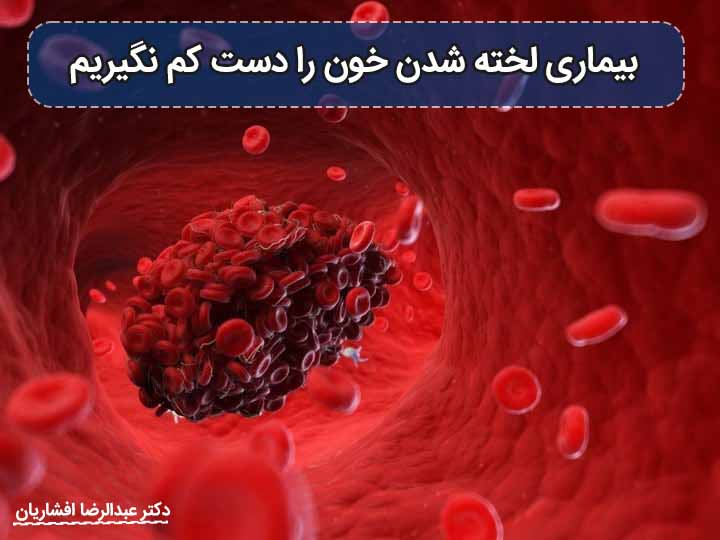 بیماری لخته شدن خون را دست کم نگیریم