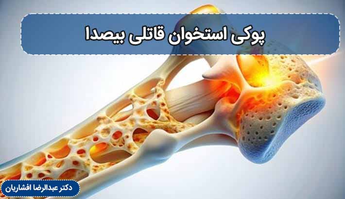 پوکی استخوان قاتلی بیصدا
