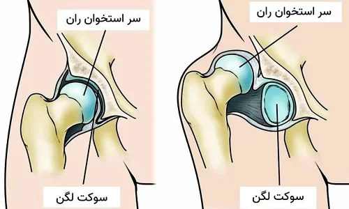 جراح لگن در مشهد