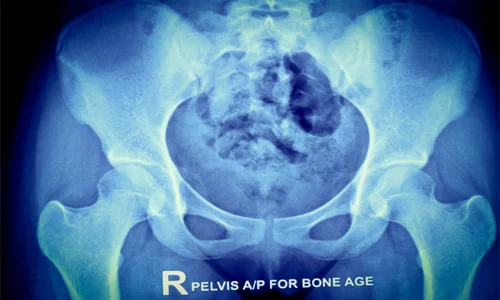 متخصص ارتوپد