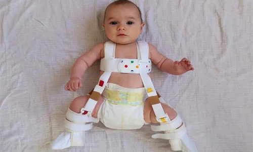 فیزیوتراپی