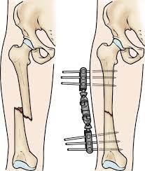 جراح لگن در مشهد