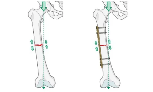 دکتر ارتوپد مشهد