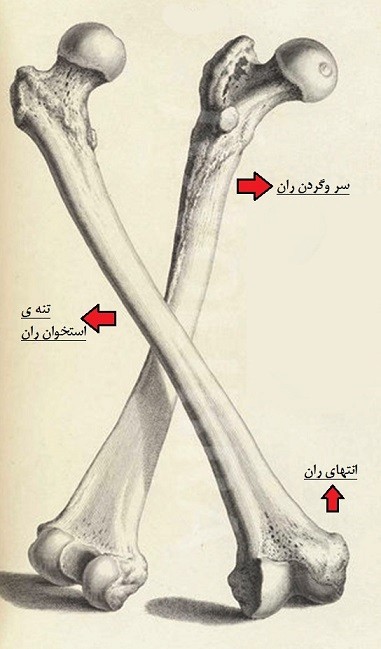 شکستگی تنه ران