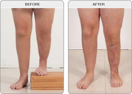 کوتاهی اندام