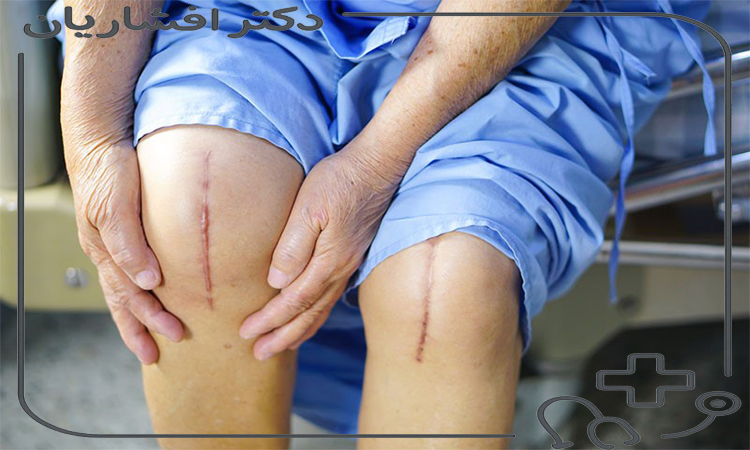 جراحی زانو
