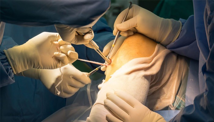 بهترین جراح مینیسک زانو