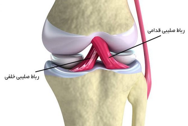 فیزیوتراپی جراحی لیگامان صلیبی قدامی