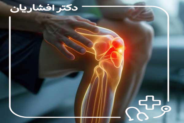 فیزیوتراپی جراحی لیگامان صلیبی قدامی