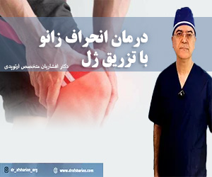 درمان انحراف زانو با تزریق ژل