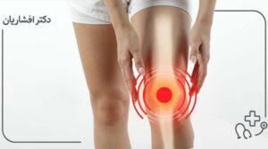 چرا زانوی من قرچ قرچ می‌کند؟