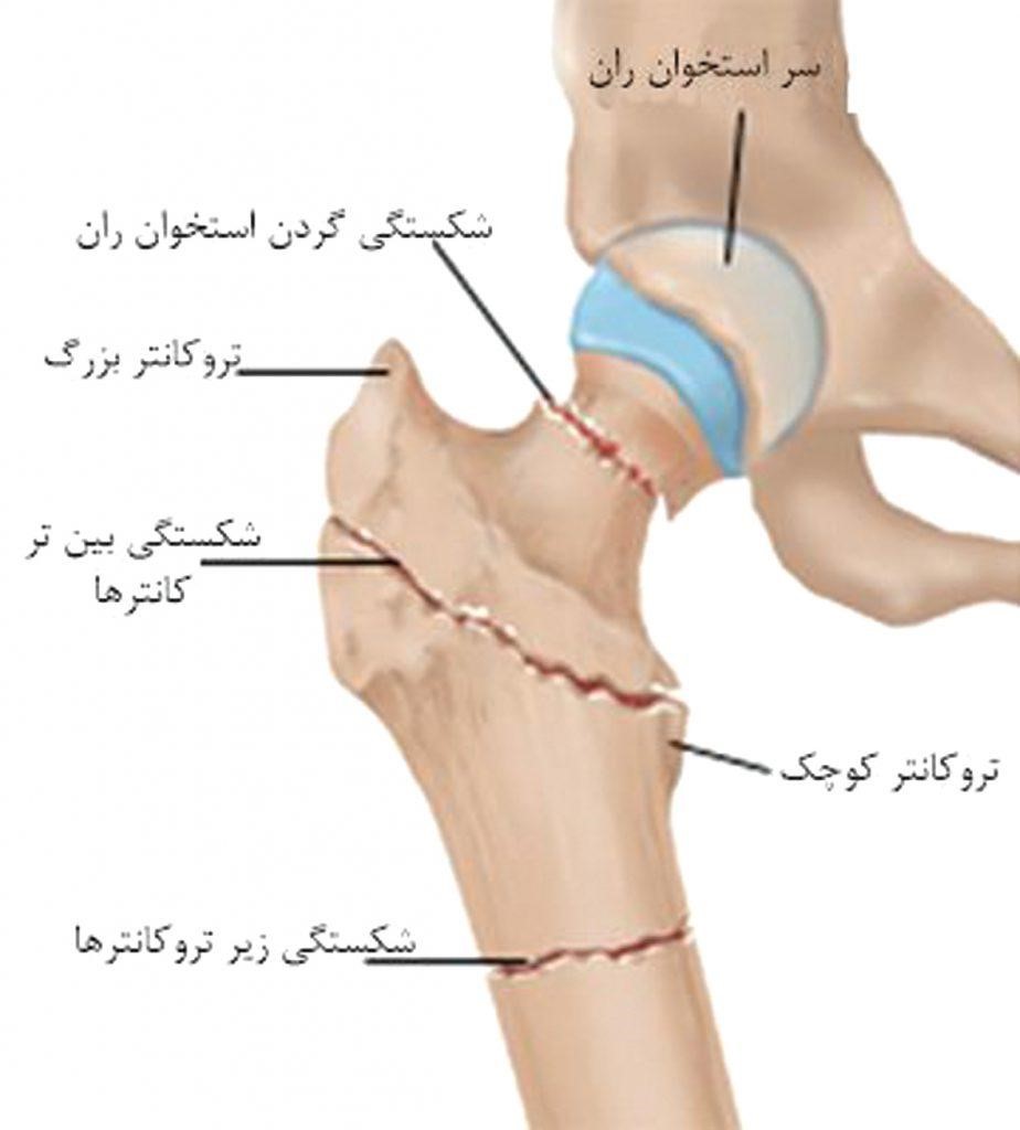 استخوان ران