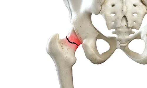 فیزیوتراپی و توانبخشی
