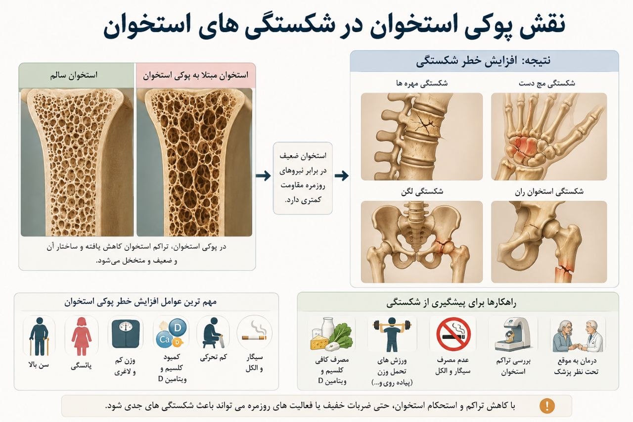 عوارض پوکی استخوان