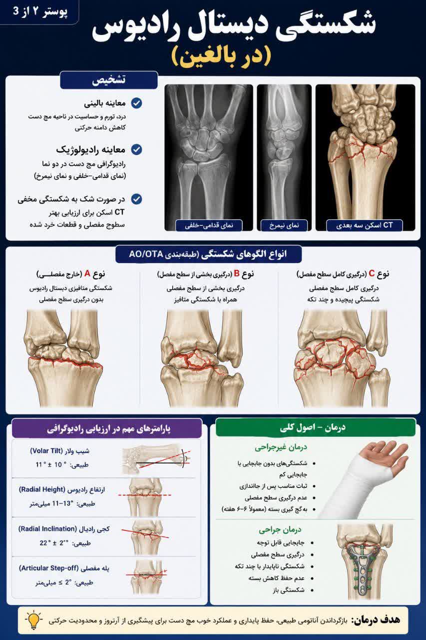 شکستگی مچ دست