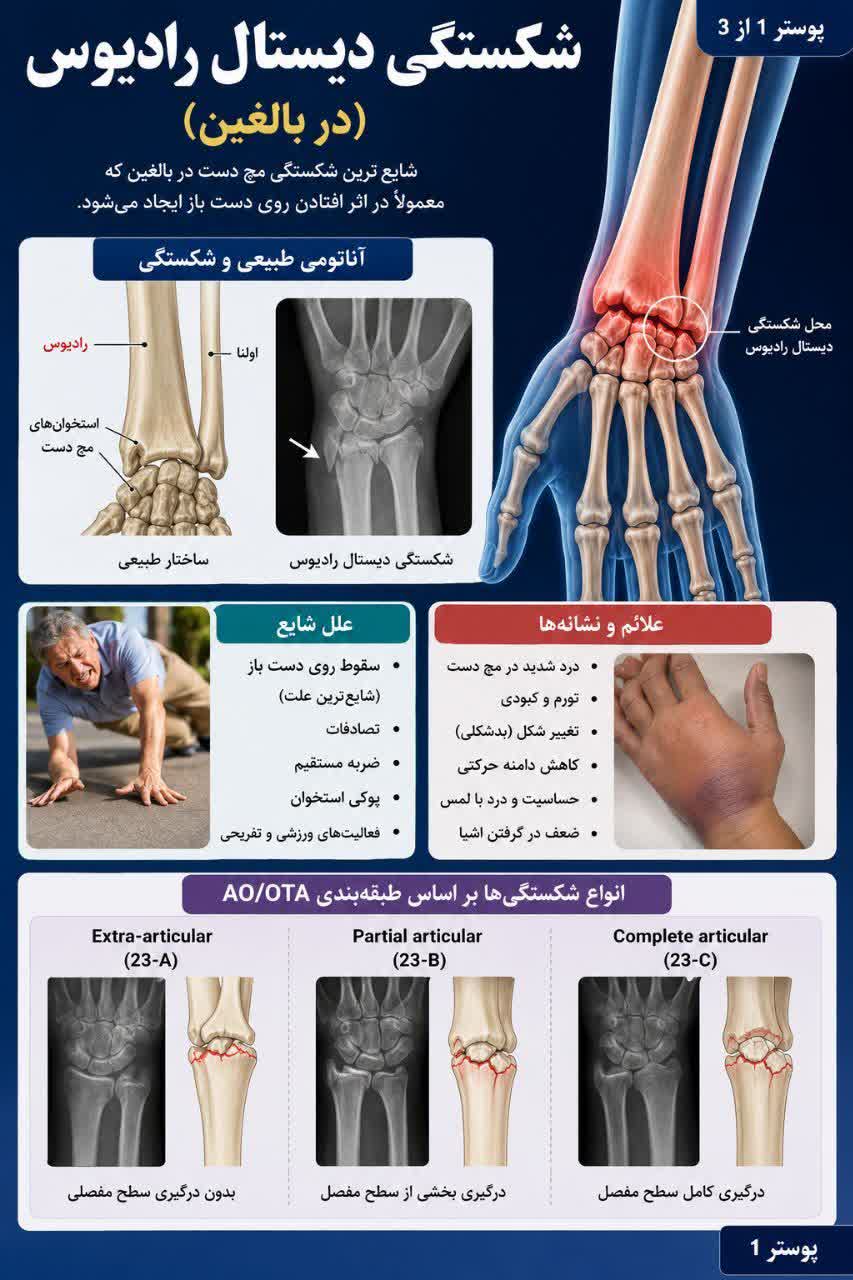 درمان - شکستگی مچ