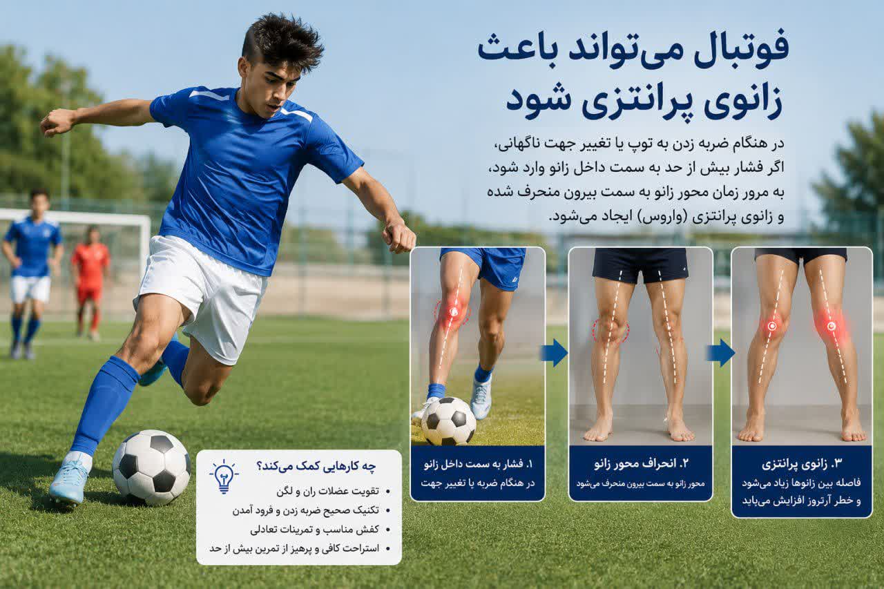ورزش - زانوی پرانتزی در بزرگسالان
