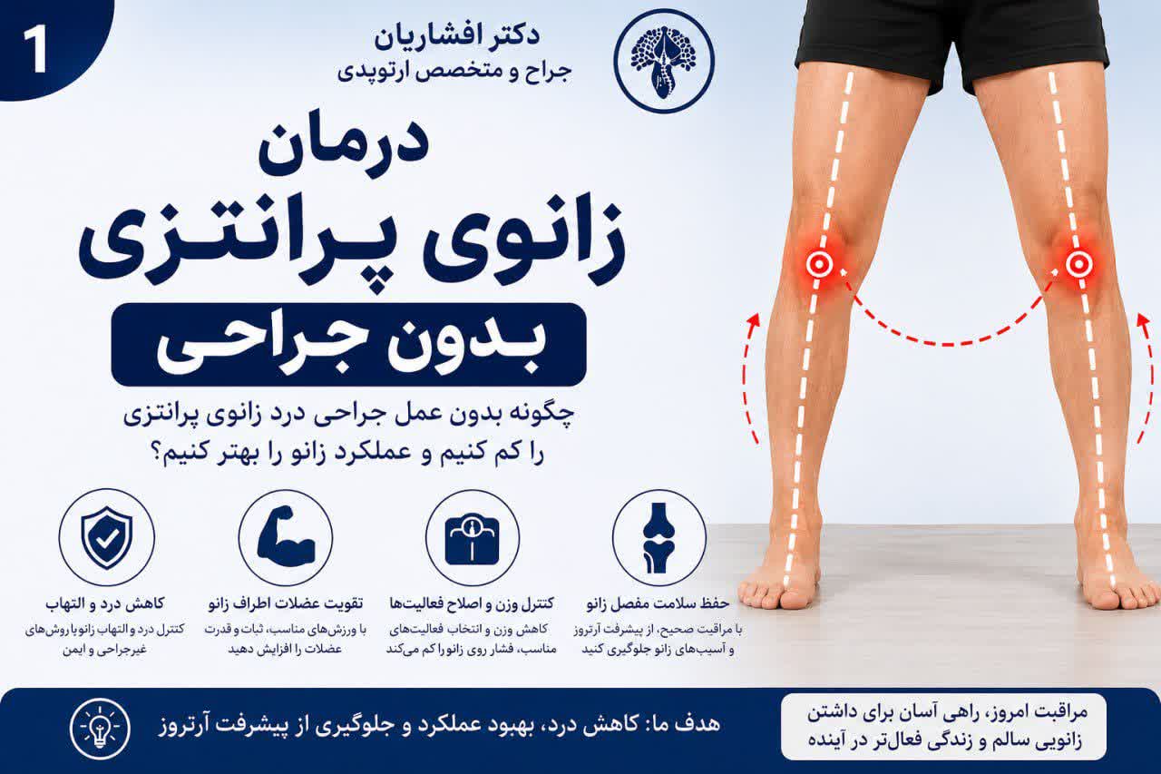 درمان زانوی پرانتزی بدون جراحی
