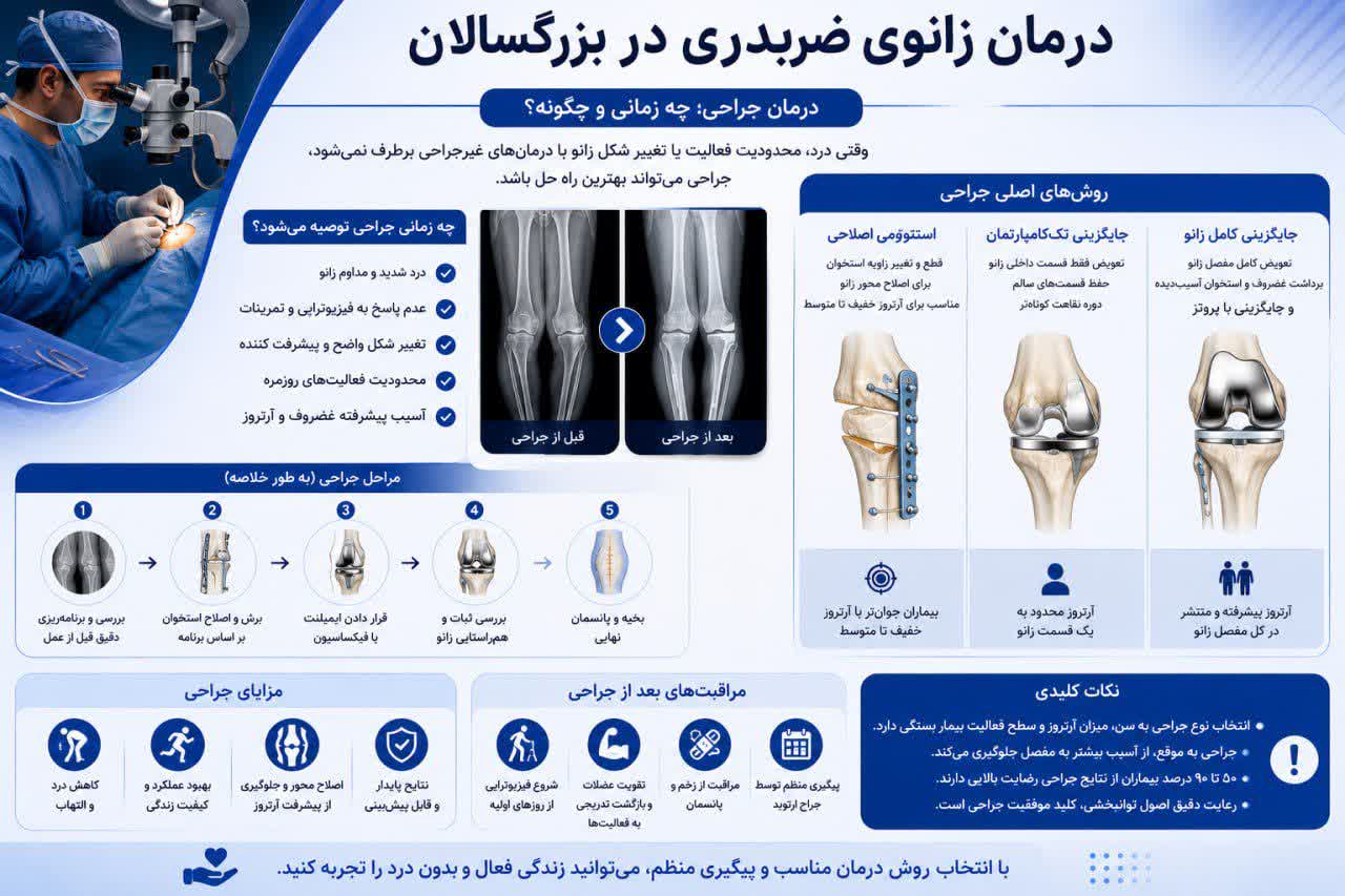 جراحی زانوی ضربدری 